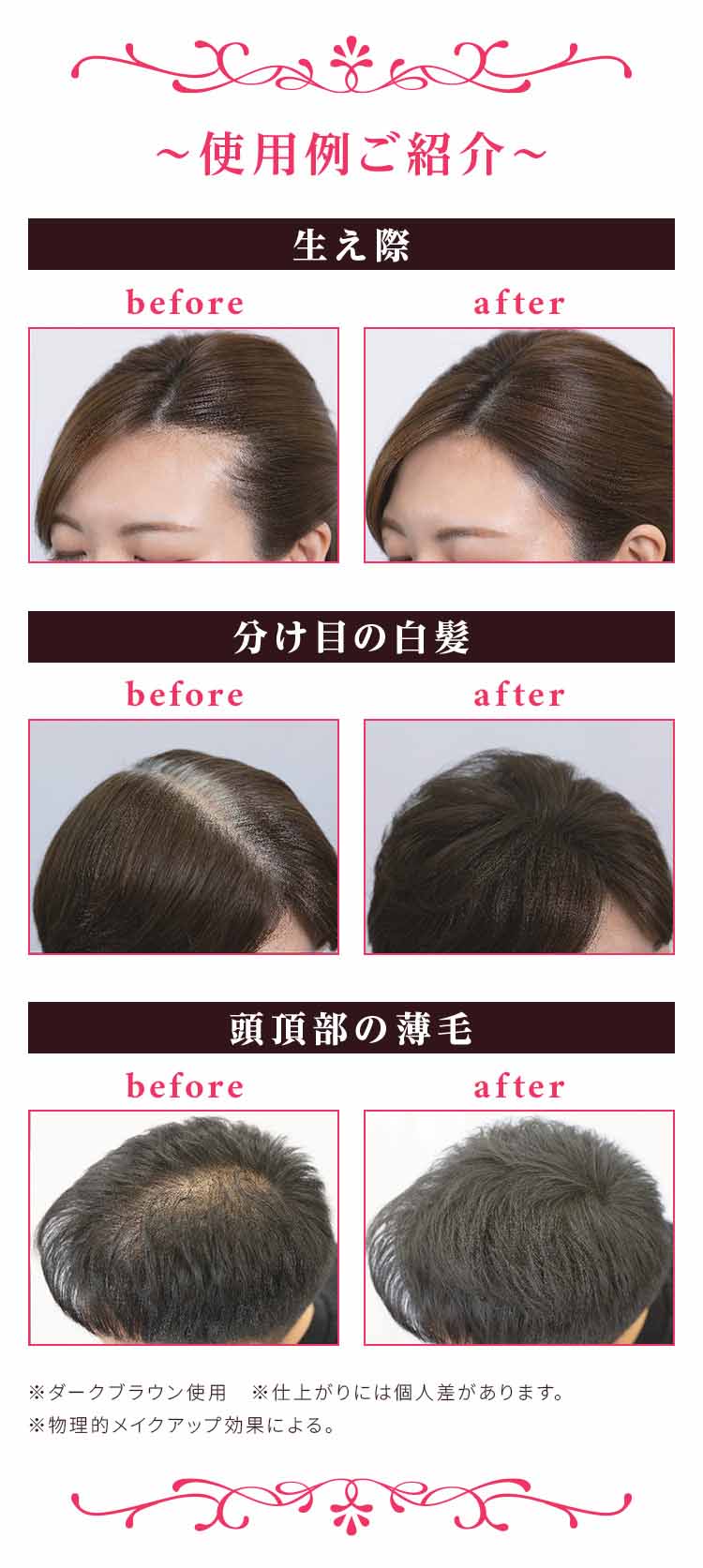 生え際、分け目の白髪、頭頂部の薄毛をそれぞれBeforeとAfterで比較した女性または男性の頭部ビジュアル。カバー力と仕上がりの変化を示す画像。