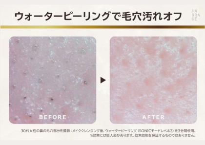 超音波の力で 毛穴汚れを浮かせて ＥＭＳ機能で表情筋ケア イングレイス　ヴェレナ アクアピールリフト モイストセラム３０ｍｌ付