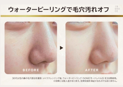 超音波の力で 毛穴汚れを浮かせて ＥＭＳ機能で表情筋ケア イングレイス　ヴェレナ アクアピールリフト モイストセラム３０ｍｌ付