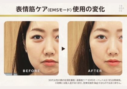 超音波の力で 毛穴汚れを浮かせて ＥＭＳ機能で表情筋ケア イングレイス　ヴェレナ アクアピールリフト モイストセラム３０ｍｌ付