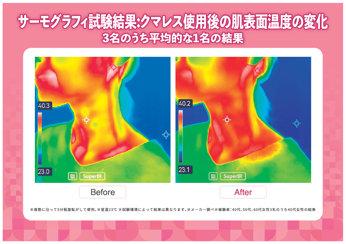 気になる目元、口元 フェイスラインスッキリ！ 手のひらサイズの美顔器 テラピスト　クマレス