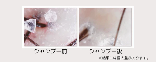 メディオール 韓国発！ こだわりの独自成分配合 髪を補修し、健やかな髪へ マイルド頭皮ケア シャンプー＆ リペアトリートメント 各２本セット